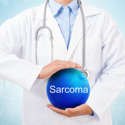 A Guide on Signs and Symptoms of Sarcoma