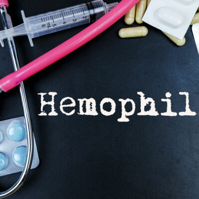 Crucial Risk Factors for Hemophilia