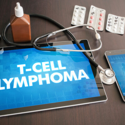 Types of Lymphoma