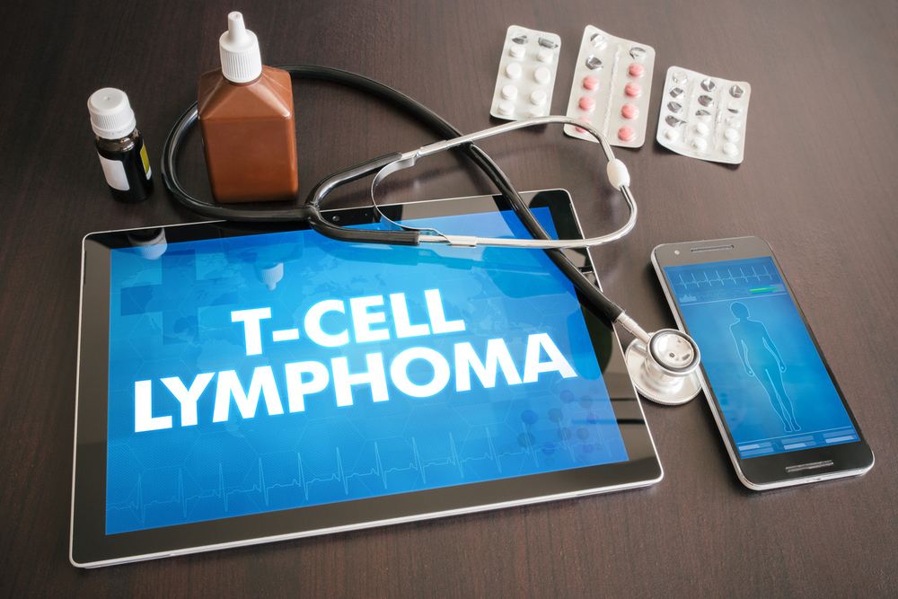 Types of Lymphoma