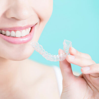 6 Advantages of Clear Aligners