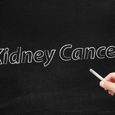 4 Symptoms Of Kidney Cancer And Its Treatment